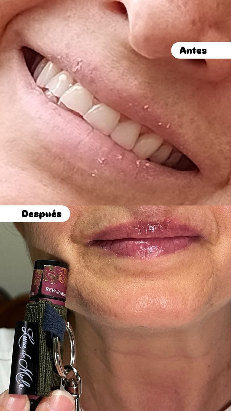 Customer photo review of Estuche | Porta BeeLips