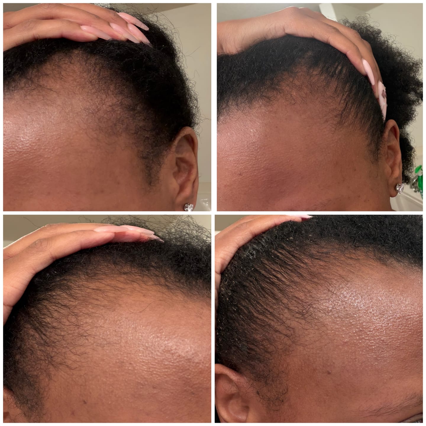 Customer photo review of BALM- Stimulating Scalp and Hair Balm