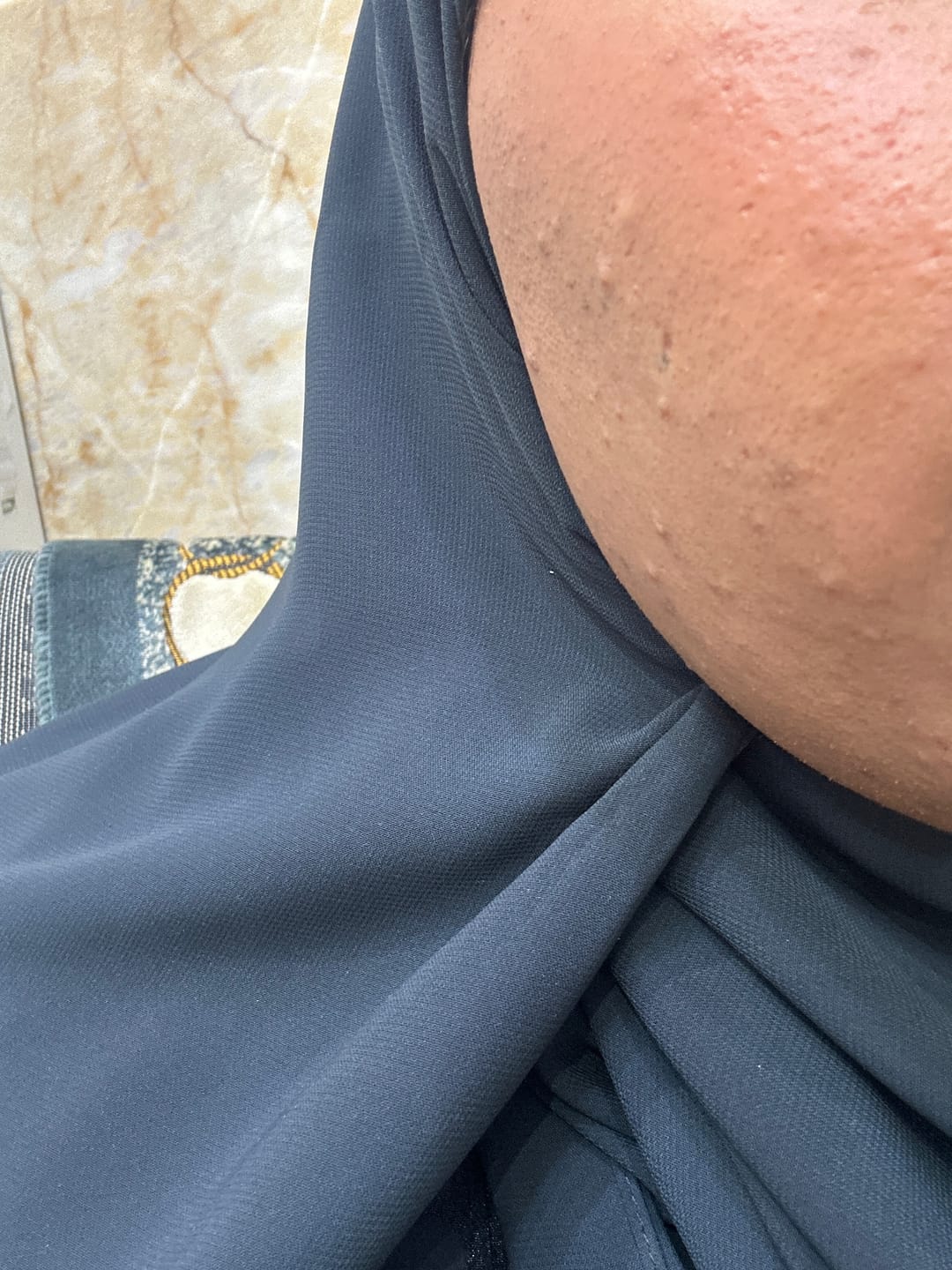 Customer photo review of غسول اكيور لتفتيح الوجه - 118مل