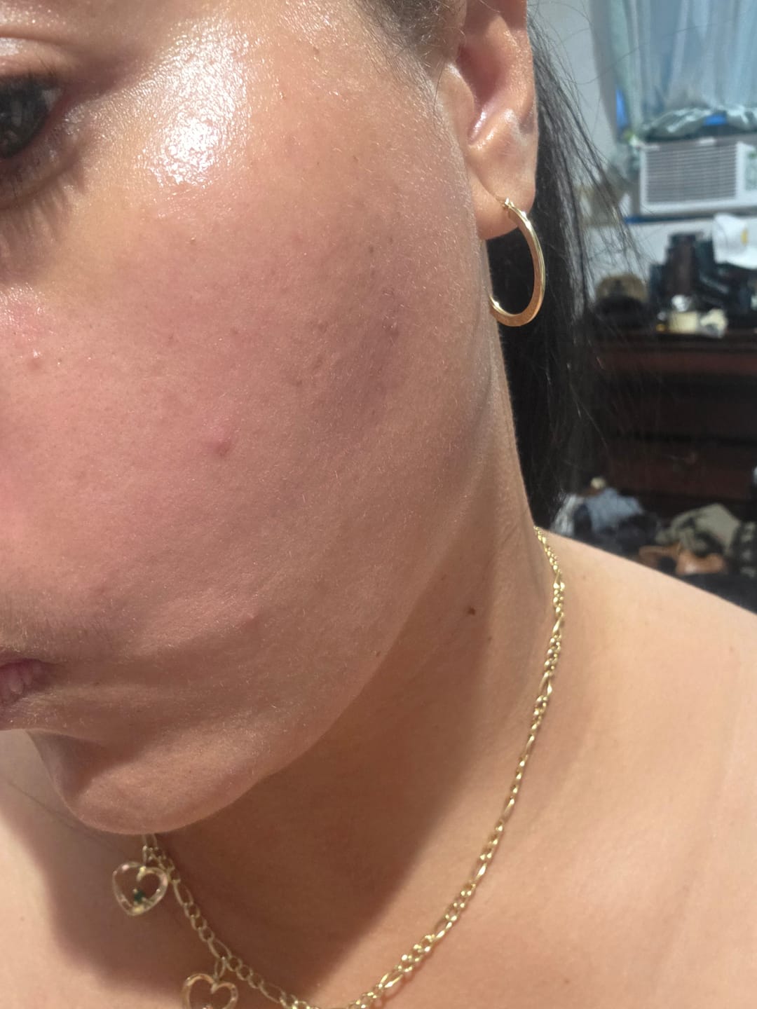 Customer photo review of Zdeer Facial Care Device | Electric Guasha Tool