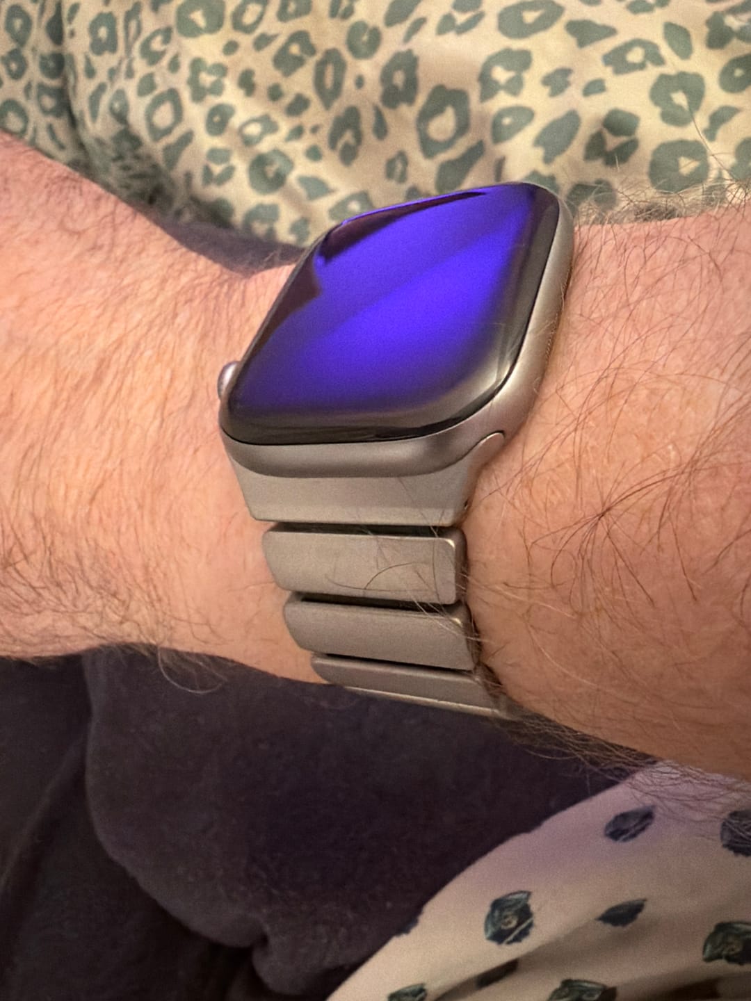 Customer photo review of 🎁 Gift Box for Apple Watch Straps (100% off)
