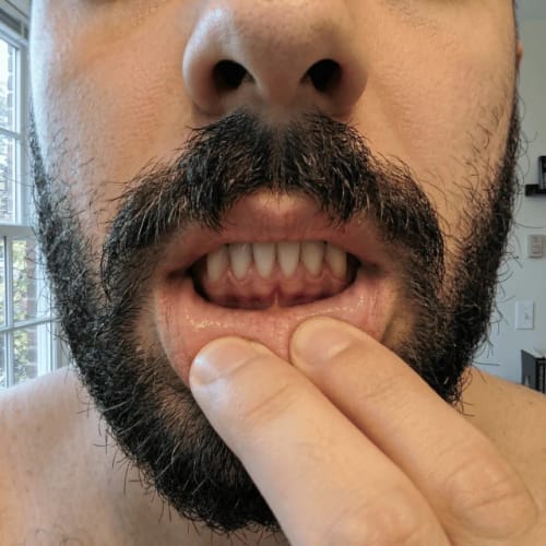 Customer photo review of Exy Red Light Toothbrush