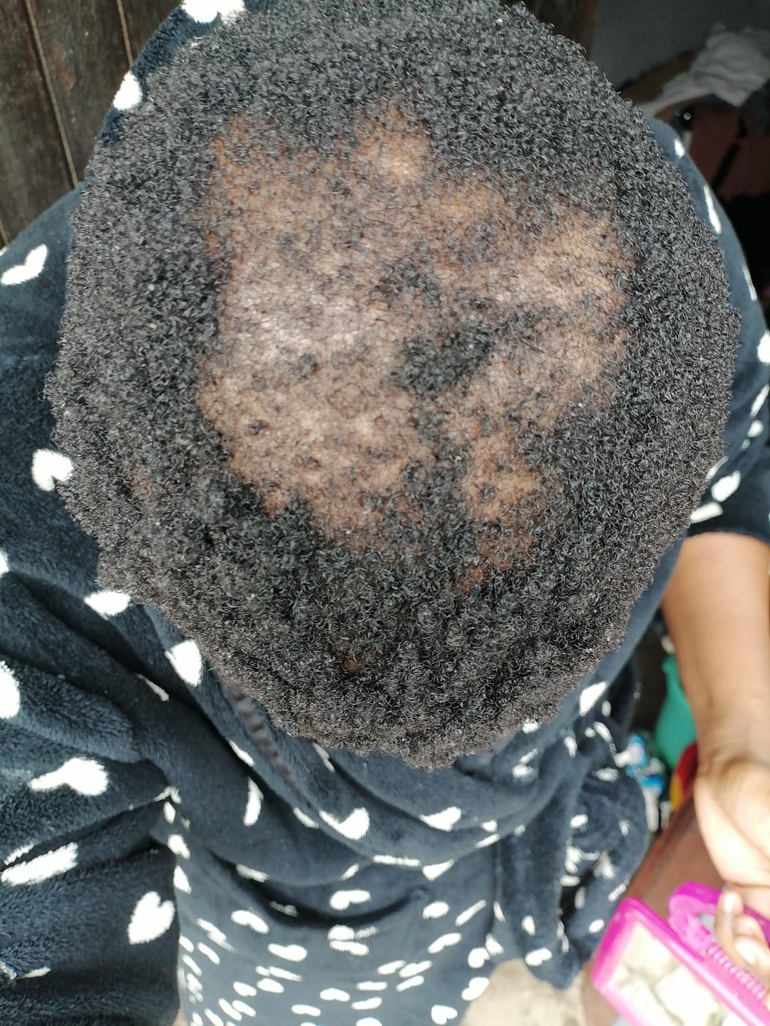 Customer photo review of Leave-In Conditioner 300ml