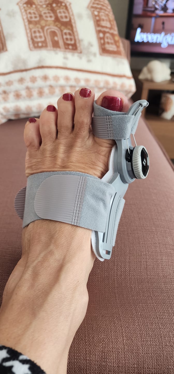 Customer photo review of Foot Medikal™ Ayak Ateli