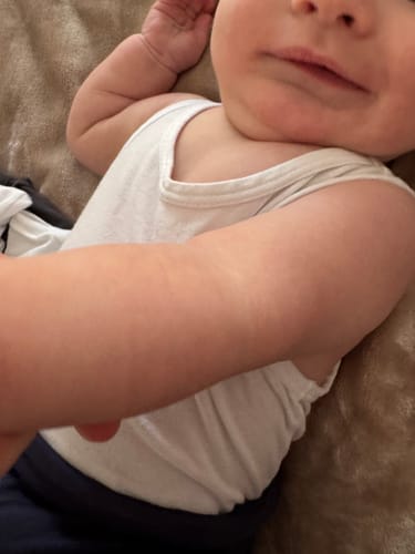 Customer's photo of a baby's arm, showing clear skin after an eczema flare-up.