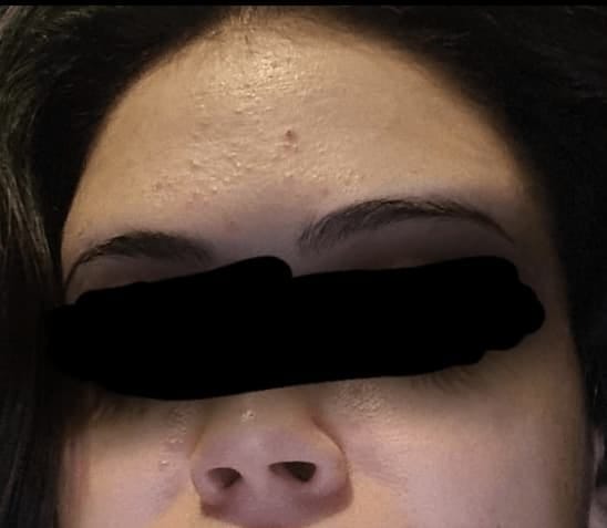 Customer photo review of Secret Teint Précieux | Jabón-Mascarilla de Leche de Cabra Anti-Imperfecciones