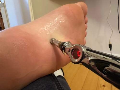 Customer photo review of Solvora Gel