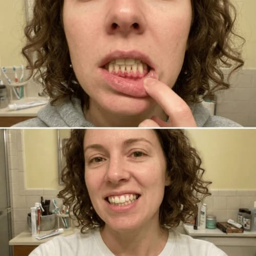 Customer photo review of Exy Red Light Toothbrush