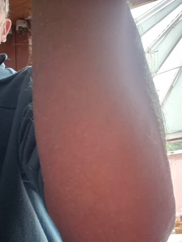 Customer photo review of Seb Natural Soothing Balm