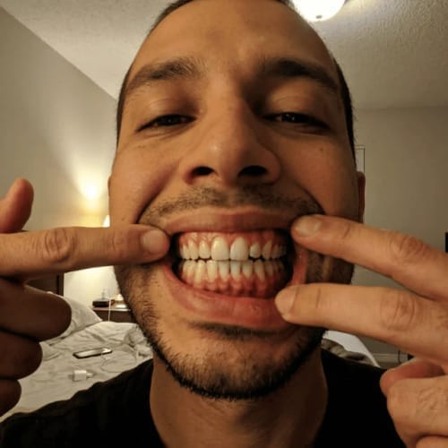 Customer photo review of Exy Red Light Toothbrush