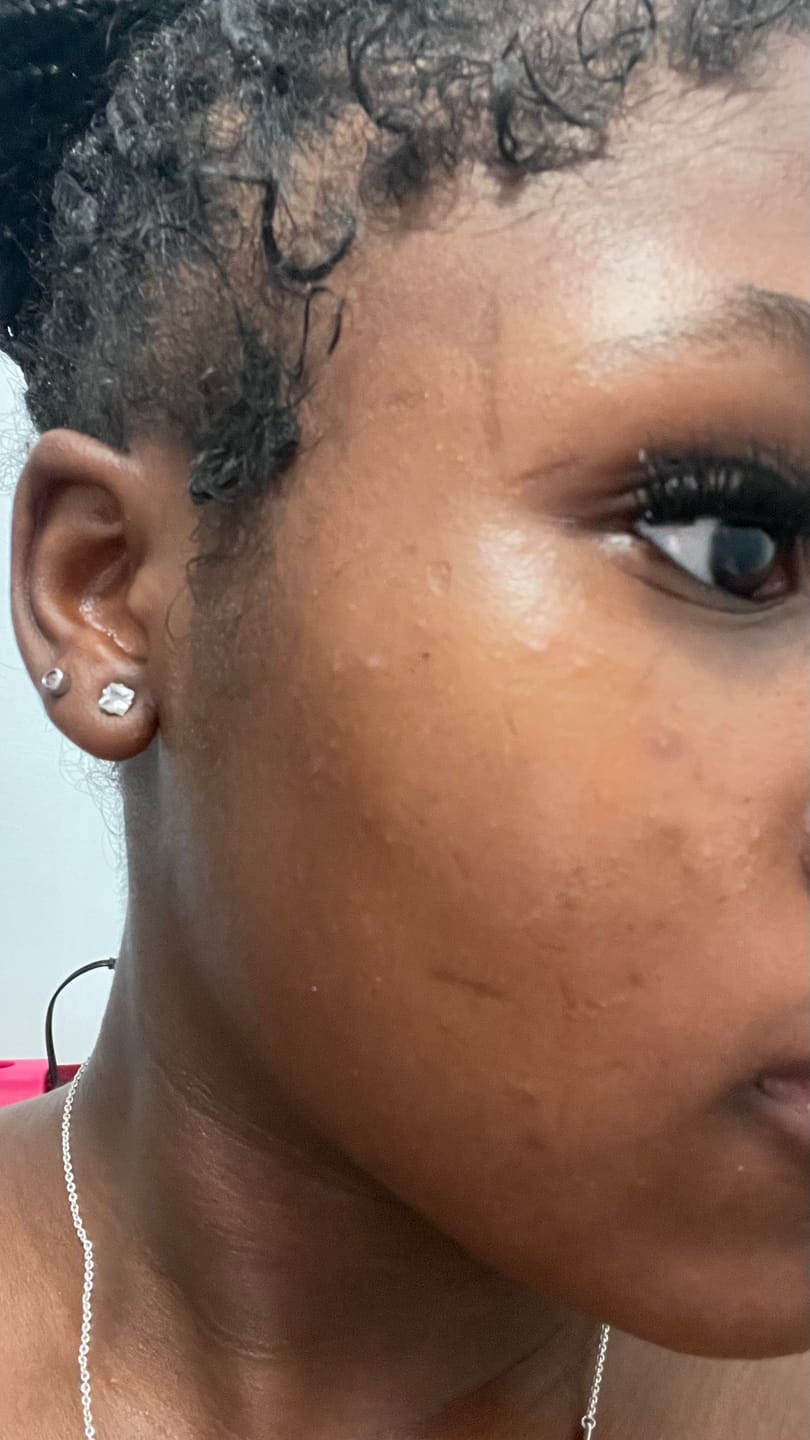 Customer photo review of Organic Turmeric Soap Bar