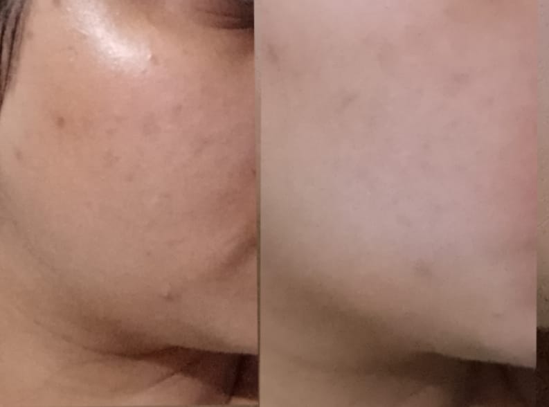 Customer photo review of Maxdif Brightening Serum