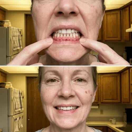 Customer photo review of Exy Red Light Toothbrush