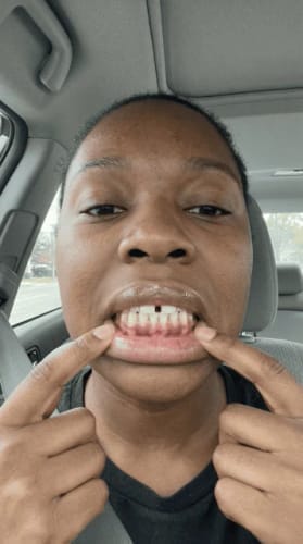 Customer photo review of Exy Red Light Toothbrush