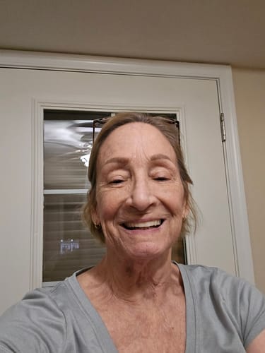 Customer photo review of Koriderm™ Time Reverse Cream (All-In-One)