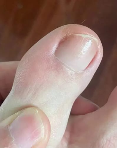 Customer photo review of Nail Care Pen