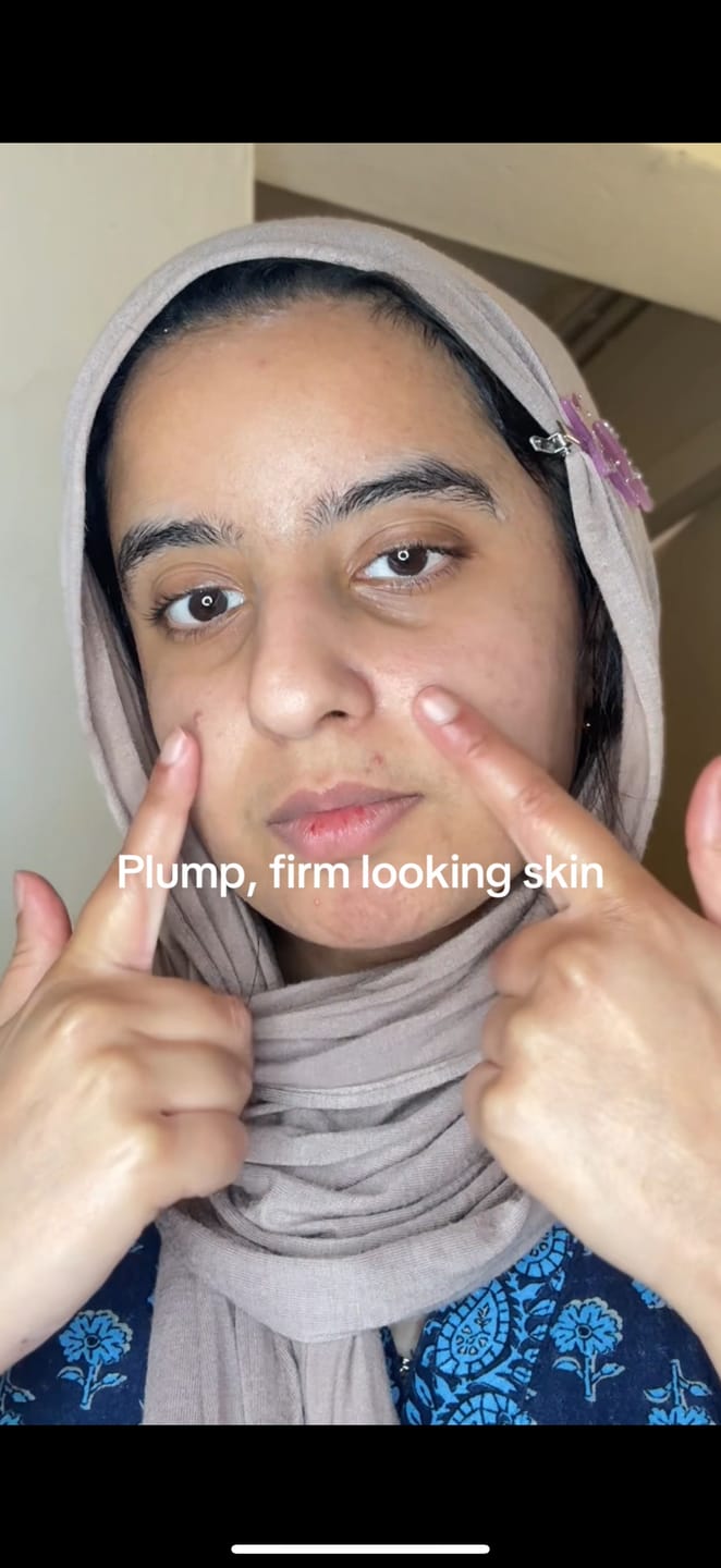 Customer photo review of PDRN Volume fill-it Booster crème 2.5 tube