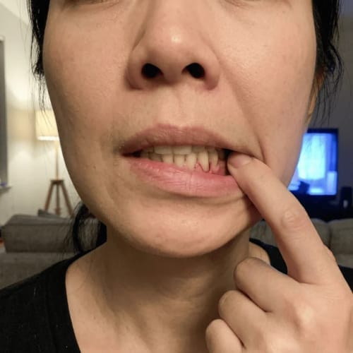 Customer photo review of Exy Red Light Toothbrush