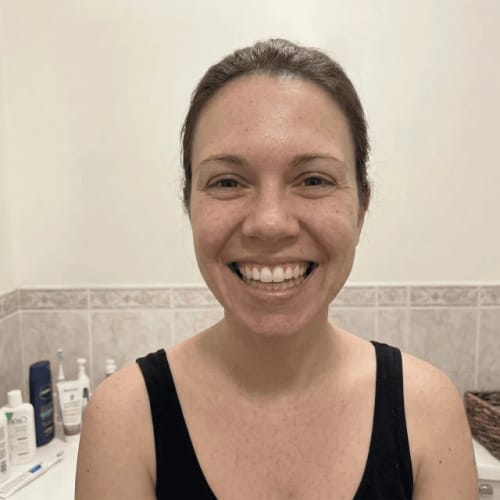 Customer photo review of Exy Red Light Toothbrush