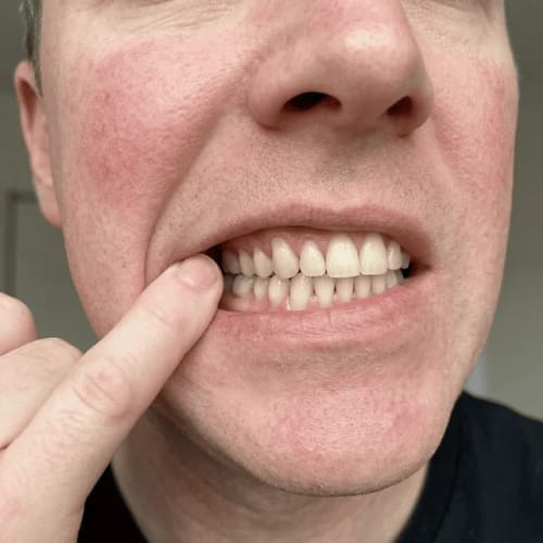 Customer photo review of Exy Red Light Toothbrush