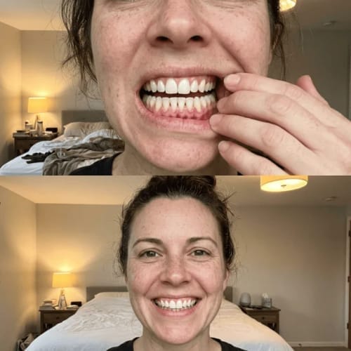 Customer photo review of Exy Red Light Toothbrush