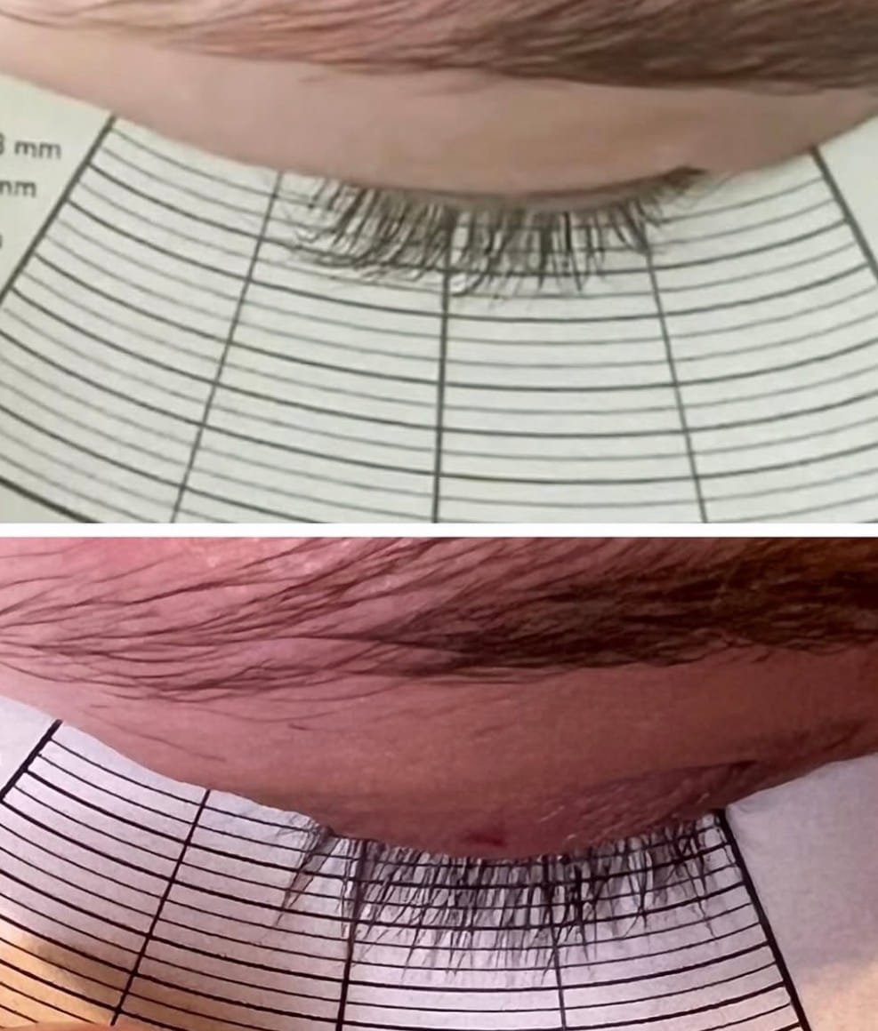 Customer photo review of Lash Growth Serum