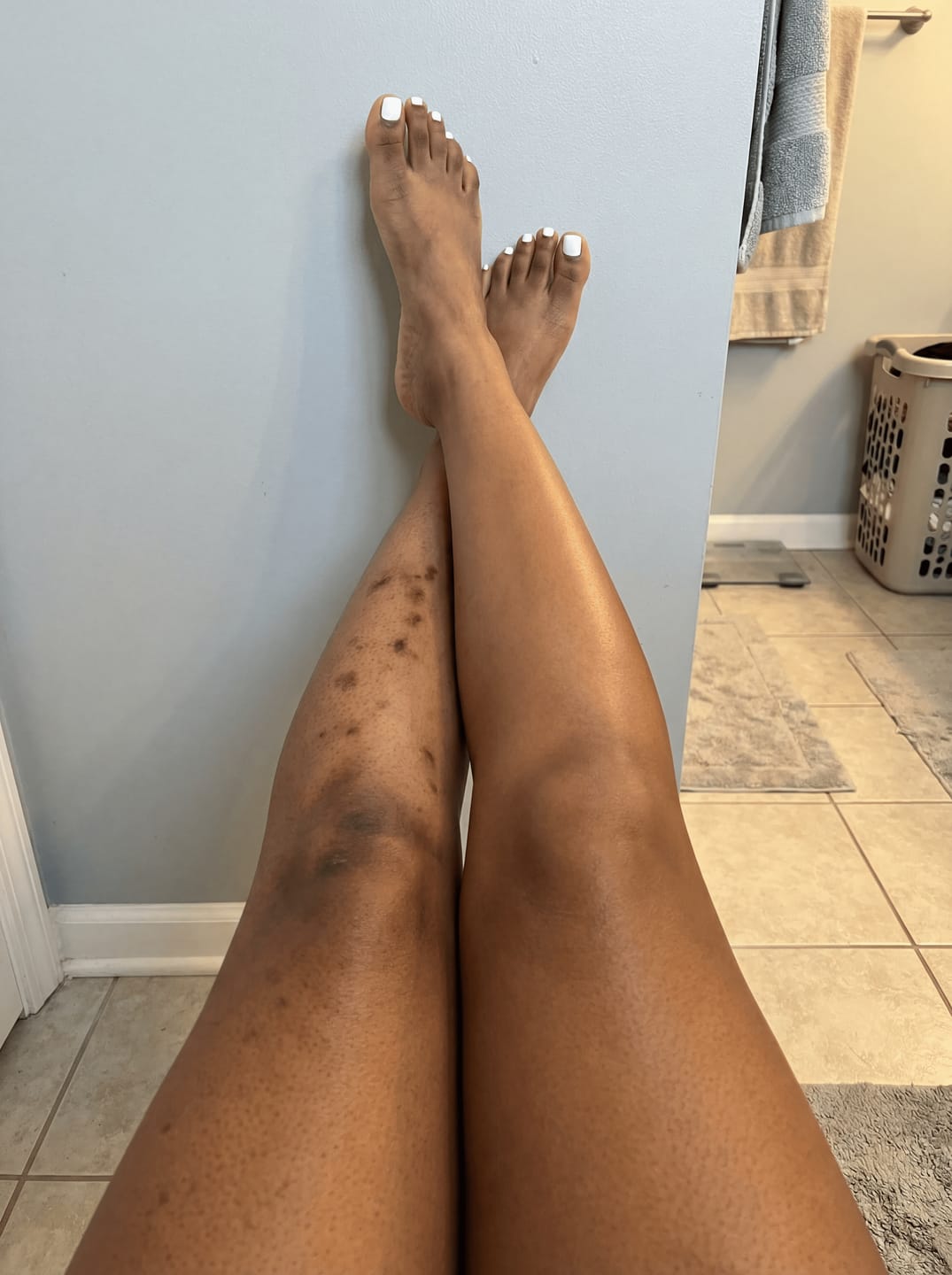 Customer photo review of Shimma™ Body Coverage Perfector Set