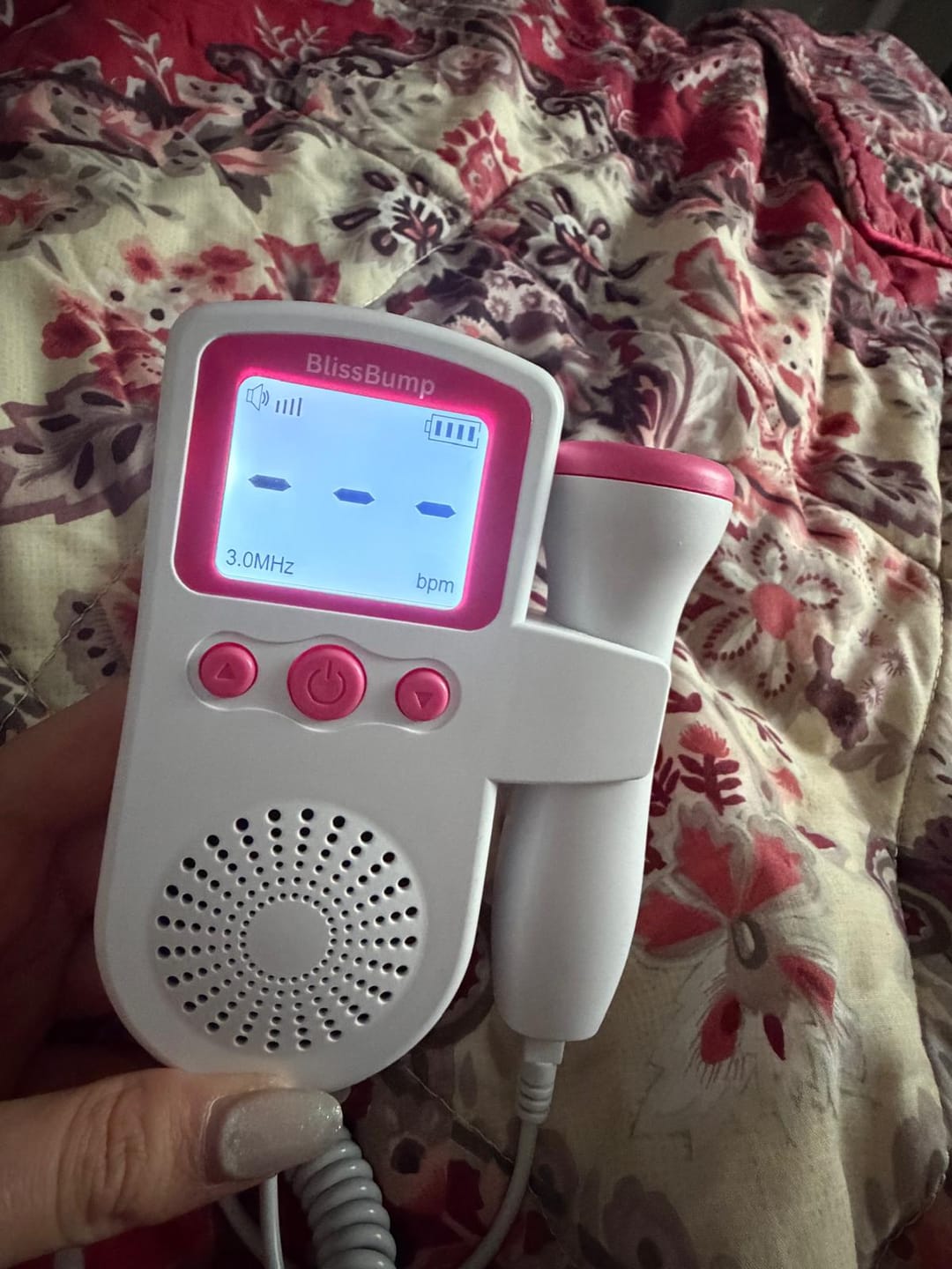 Customer photo review of BabyEcho Doppler™
