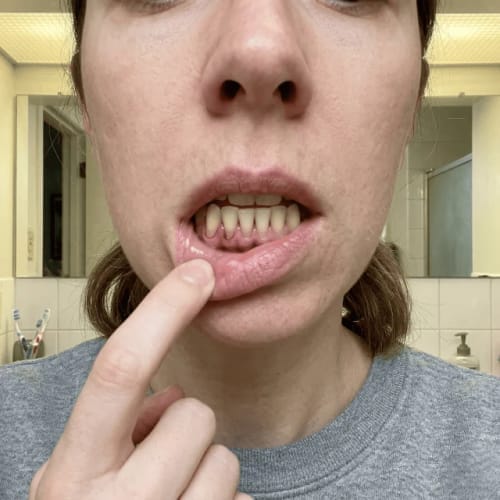 Customer photo review of Exy Red Light Toothbrush