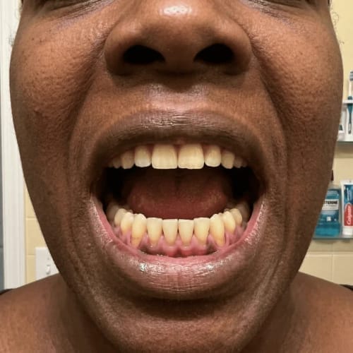 Customer photo review of Exy Red Light Toothbrush
