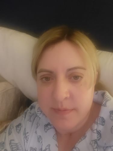 Customer's close-up selfie showing her facial skin after using Koriderm™ Time Reverse Cream.