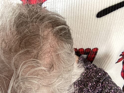 Close-up of a reviewer's scalp showing thin, grey hair, the condition the rosemary shampoo is intended to treat.
