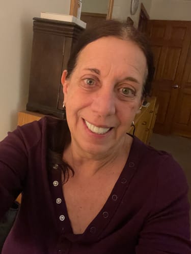 Customer photo review of Koriderm™ Time Reverse Cream (All-In-One)
