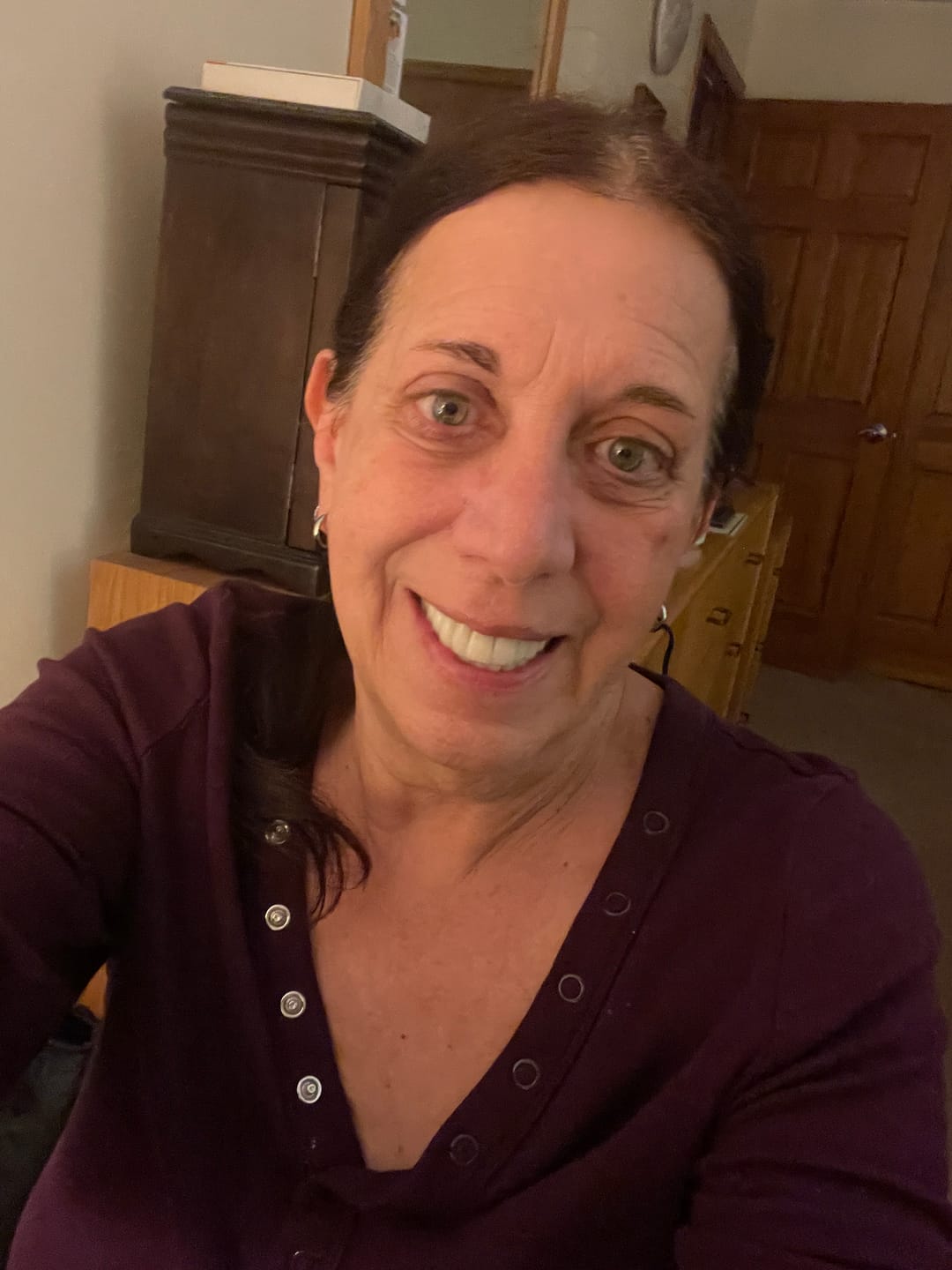 Customer photo review of Koriderm™ Time Reverse Cream (All-In-One)
