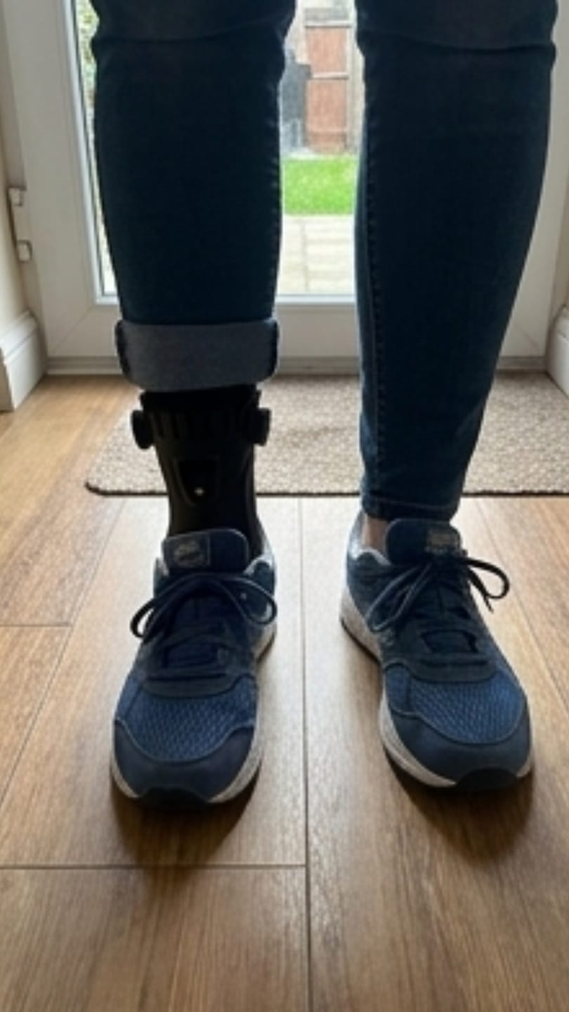 Customer photo review of Orthevo | Fußheberorthese