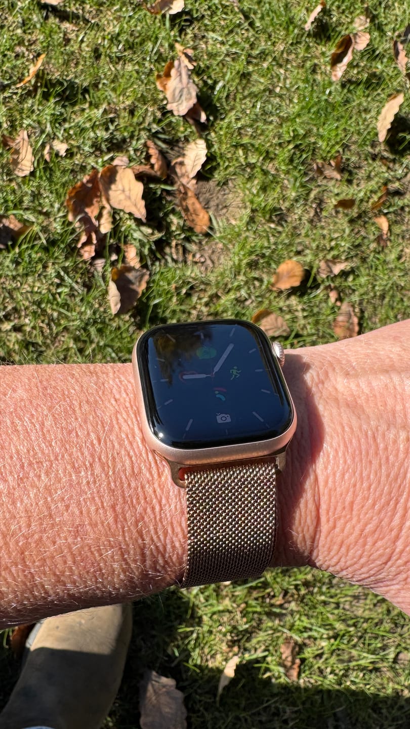Customer photo review of Milanese Loop