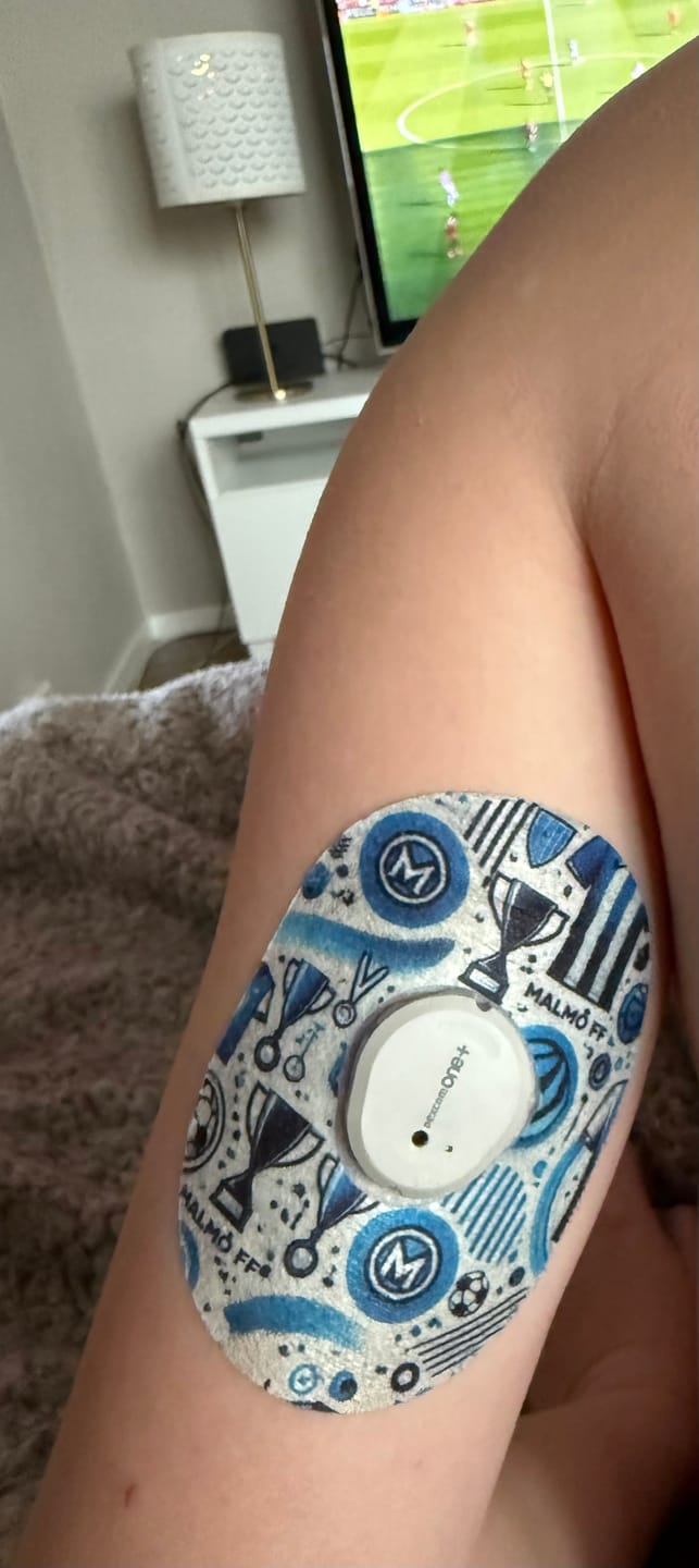 Customer photo review of Dexcom G7 Malmö fotboll CGM-Sensor overpatches