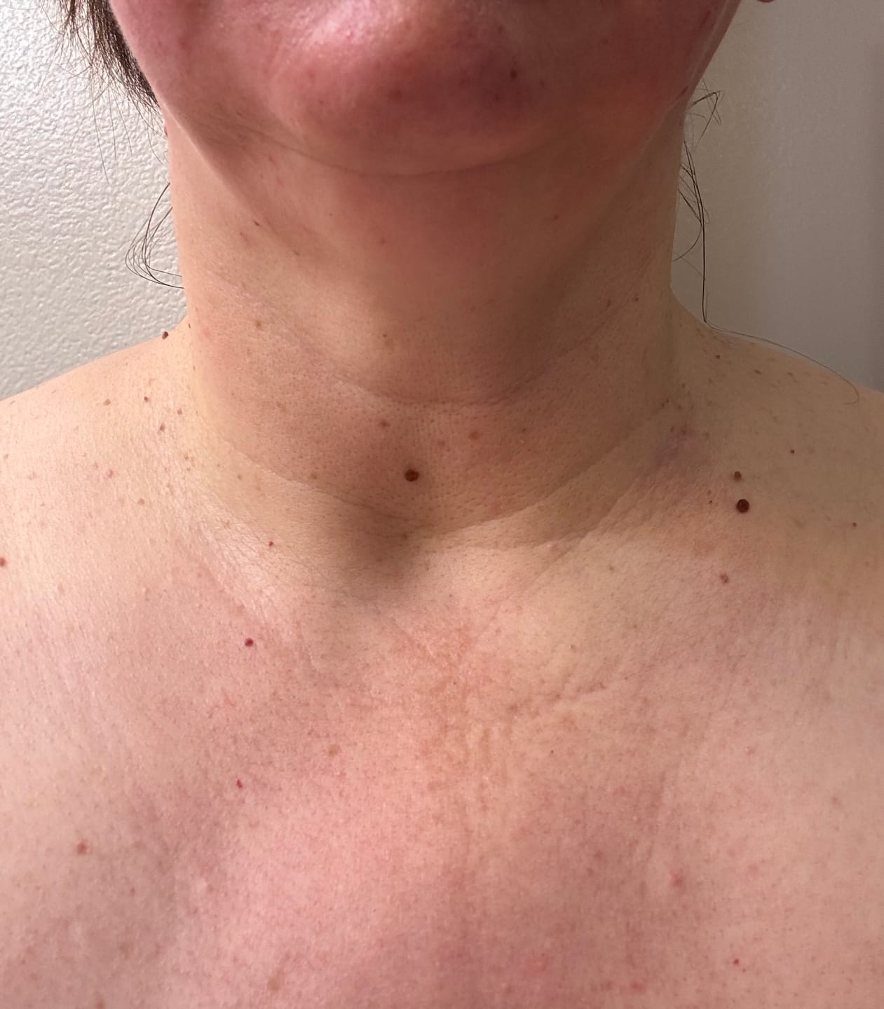 Customer photo review of INIA GLOW Neck & Chest Red Light Therapy