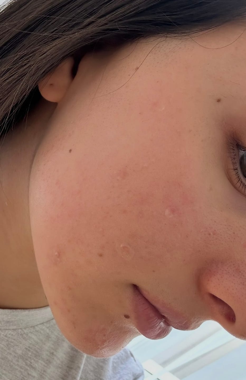 Customer photo review of Turmeric Glow Moisturiser