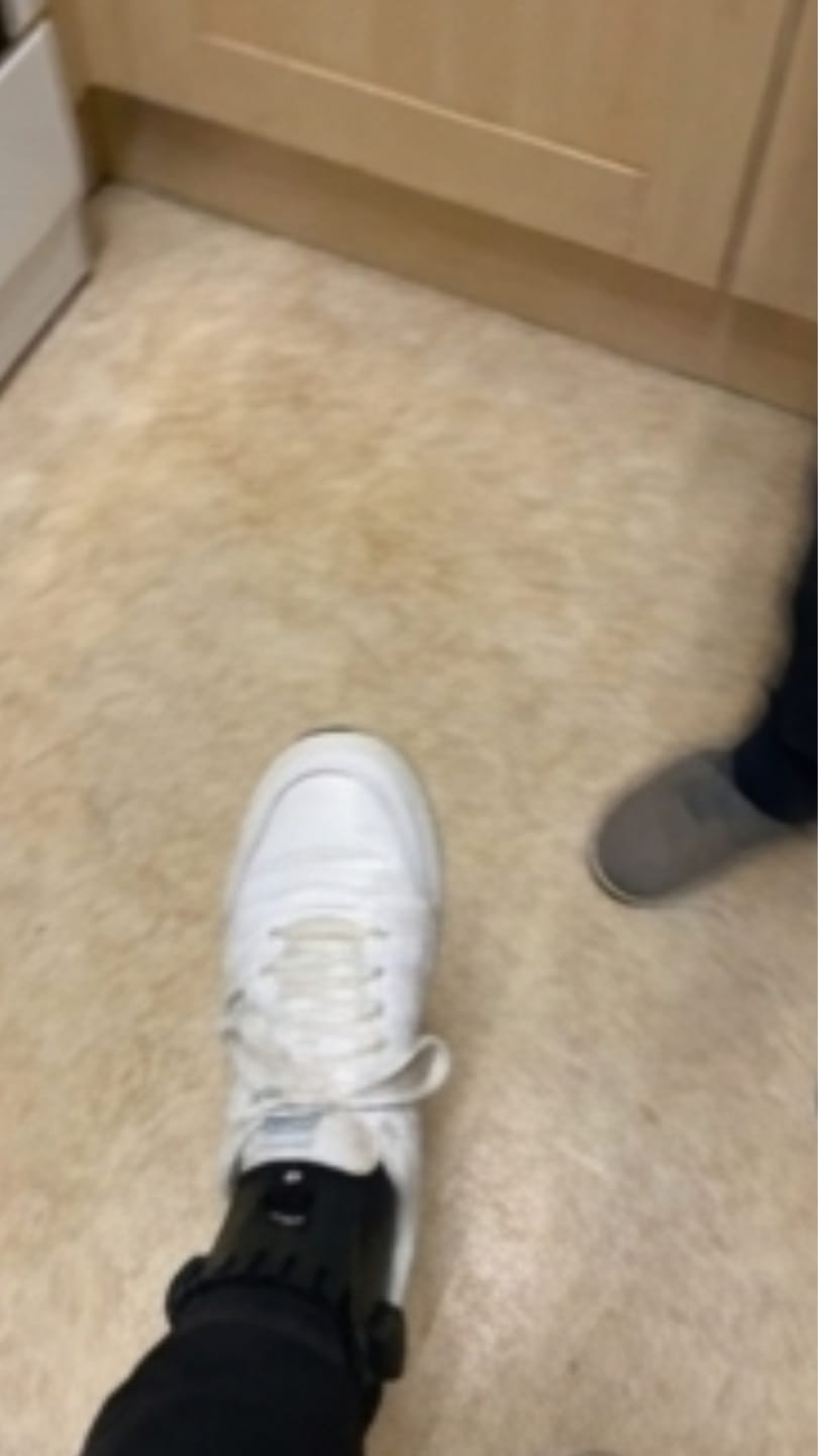 Customer photo review of Orthevo | Fußheberorthese