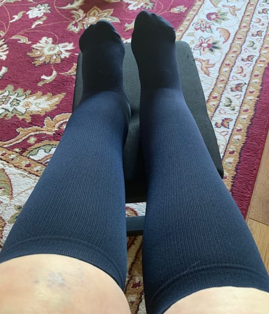 Customer photo review of EverSock™ Wide Compression Socks For Pain Relief