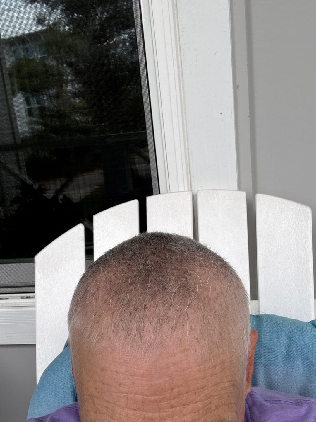 Customer photo review of Chemo Hair and Scalp Care Bundle