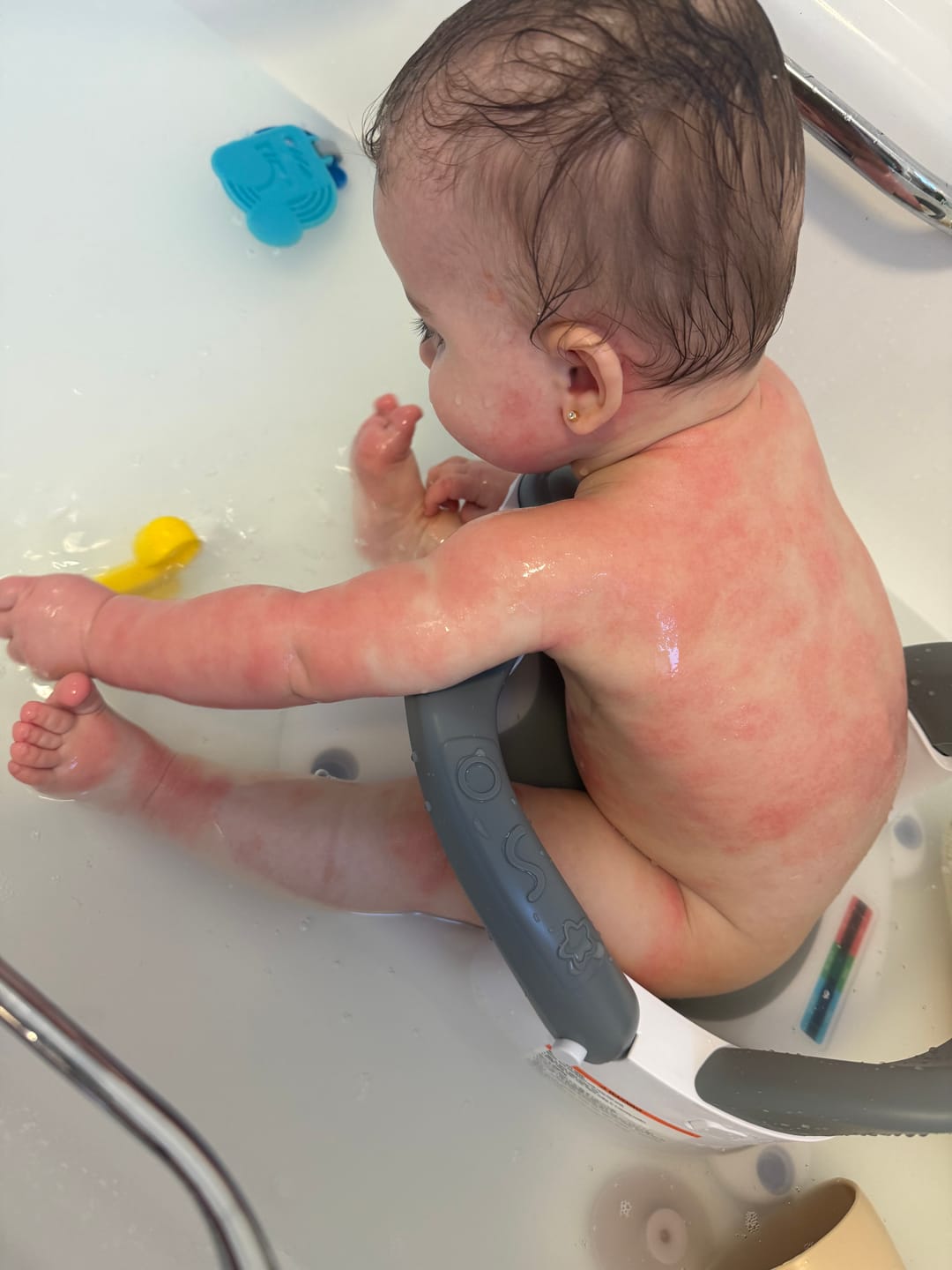 Customer photo review of Bioskin Junior Value Bundle