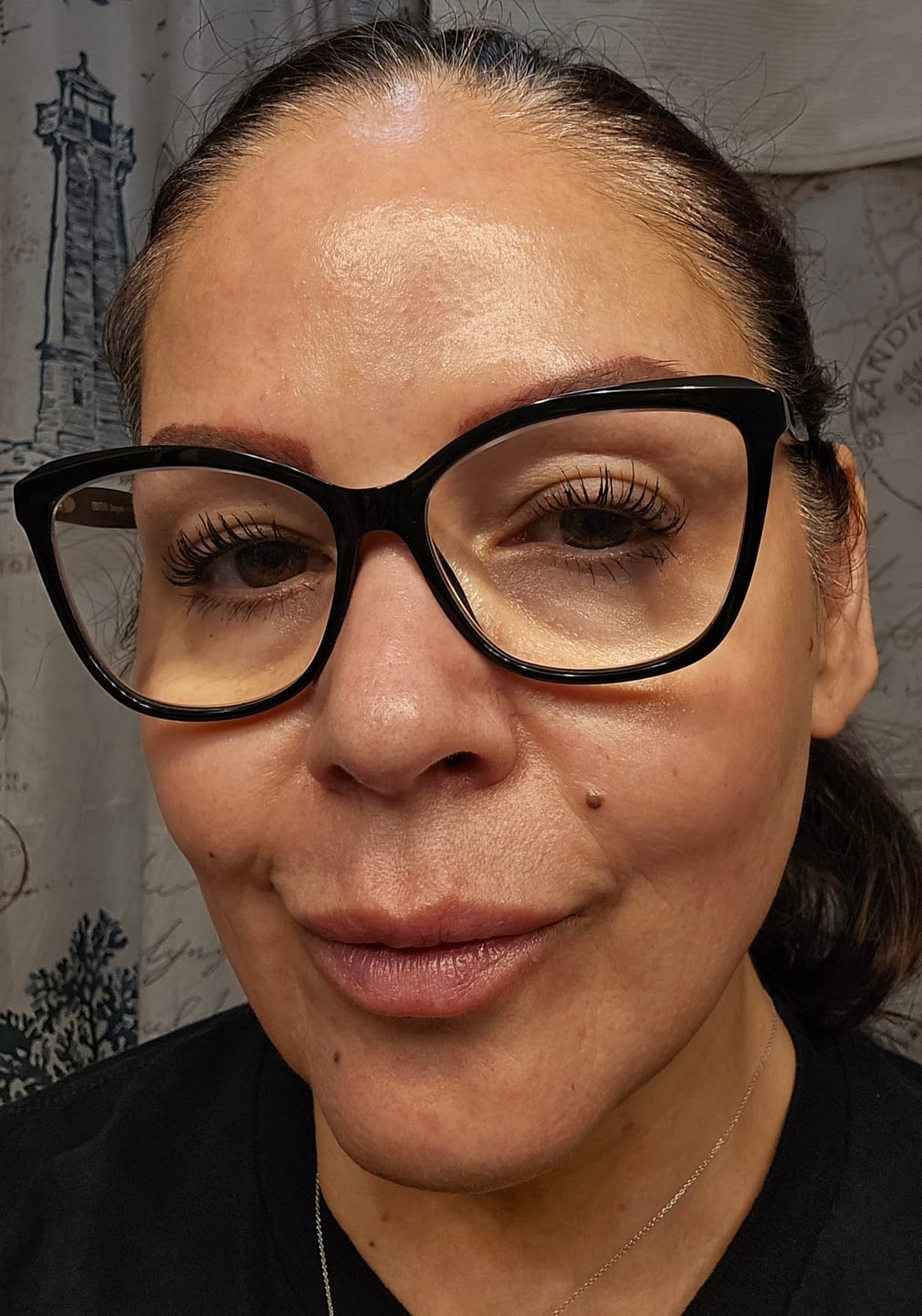 Customer photo review of Expert Madeca Cream Active Renew PDRN 50ml