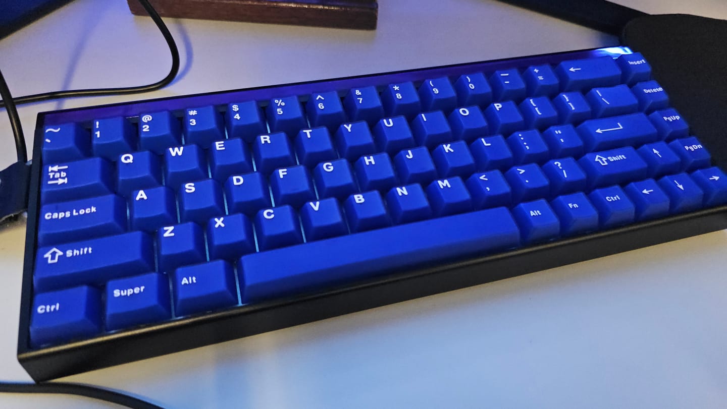 Customer photo review of XVX Frost Jade Tuş Takımı