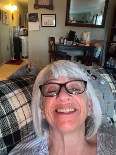 Customer photo review of Koriderm™ Time Reverse Cream (All-In-One)