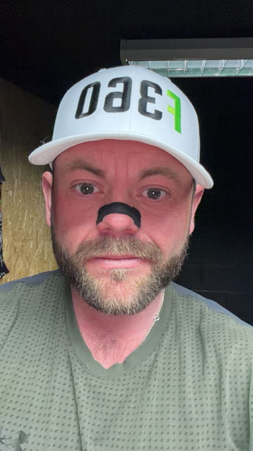 Customer photo review of Black Nasal Strips