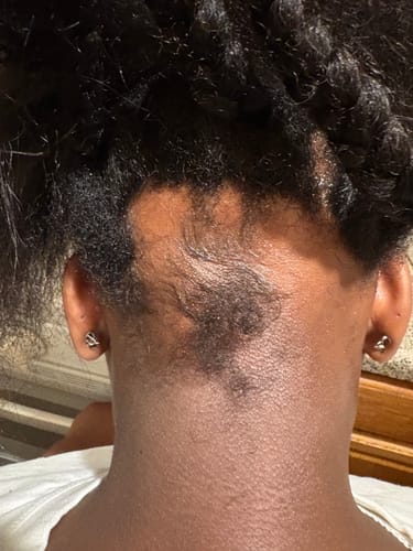 Customer photo review of Miracle Hair Growth Oil