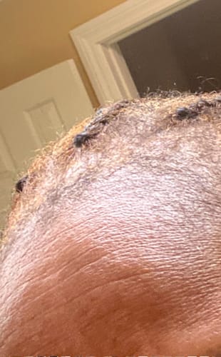 Customer photo review of Rennora Hair Growth Serum