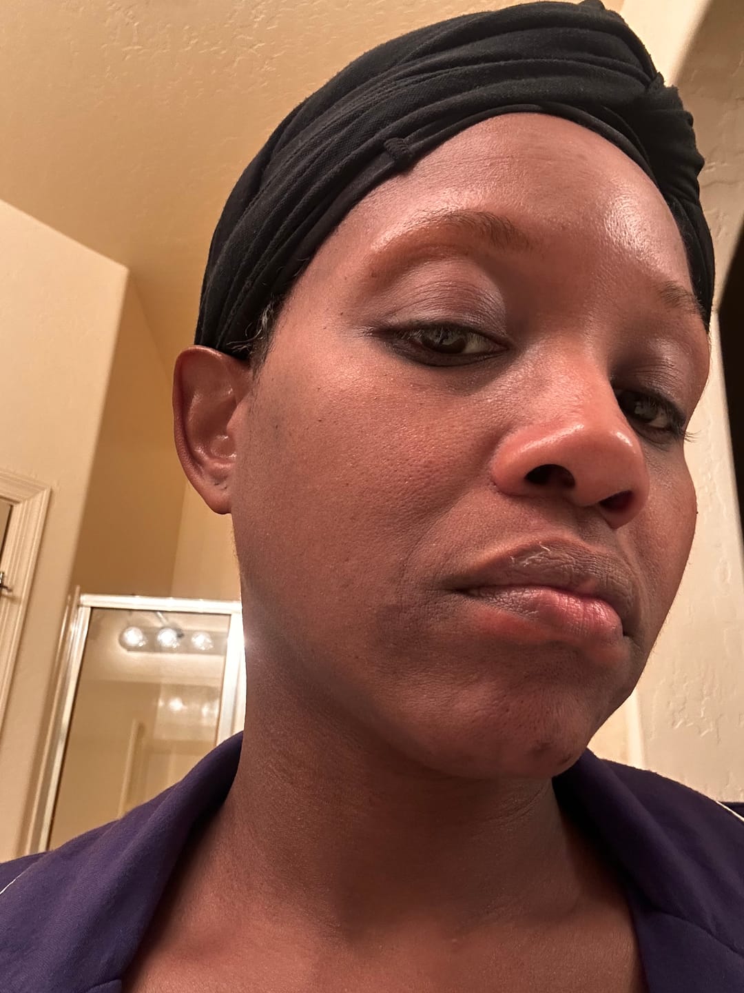 Customer photo review of Turmeric and Kojic Foaming Face Wash